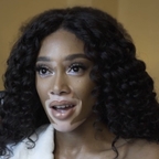 Winnie Harlow