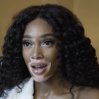 Winnie Harlow Autograph Profile